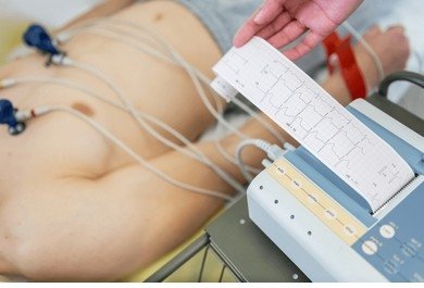 ECG